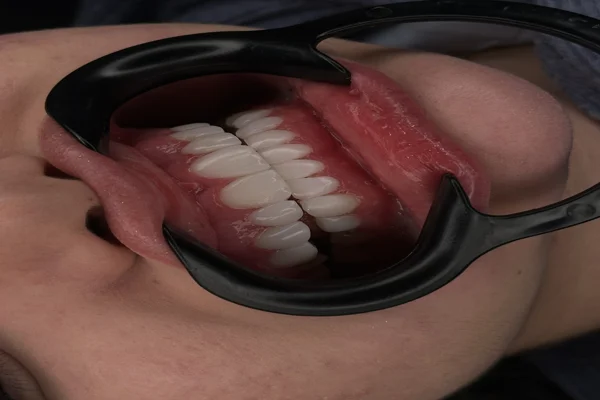 دندانپزشکی زیبایی کرج ماهانا