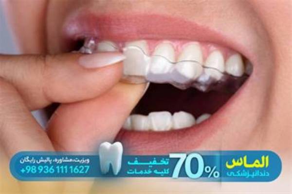 معاینات تخصصی دندان پزشکی و جرم گیری رایگان دندان
